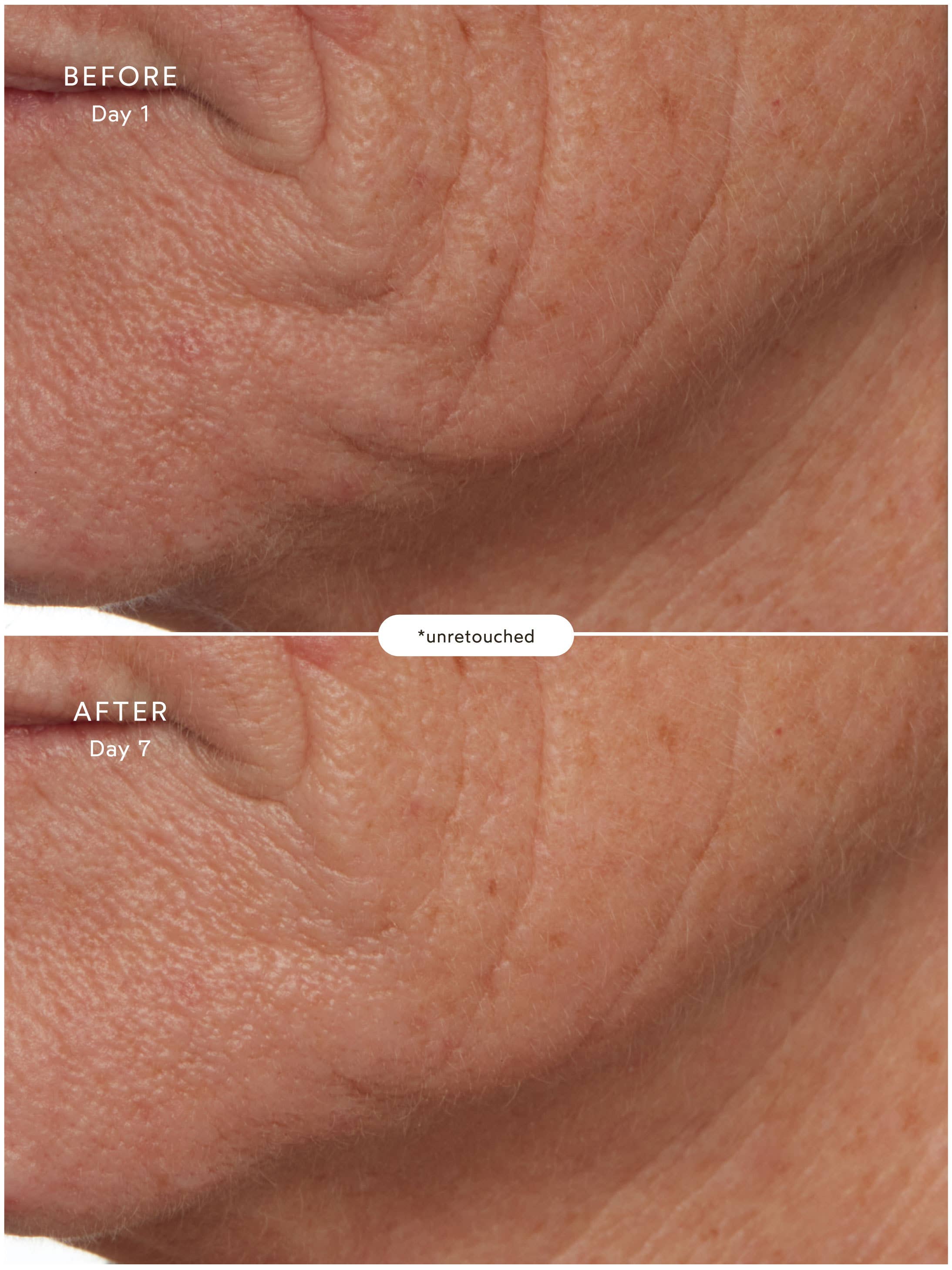 SuperSEA Firming & Lifting Treatment