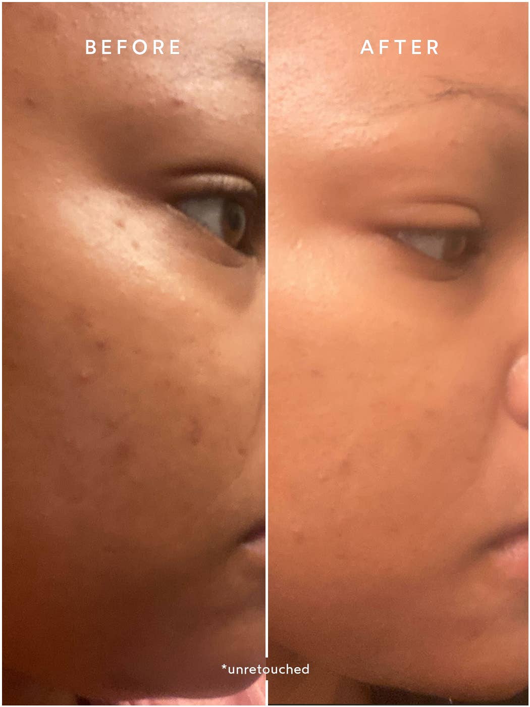 Niacinamide + Biotin Booster - Free Living Co