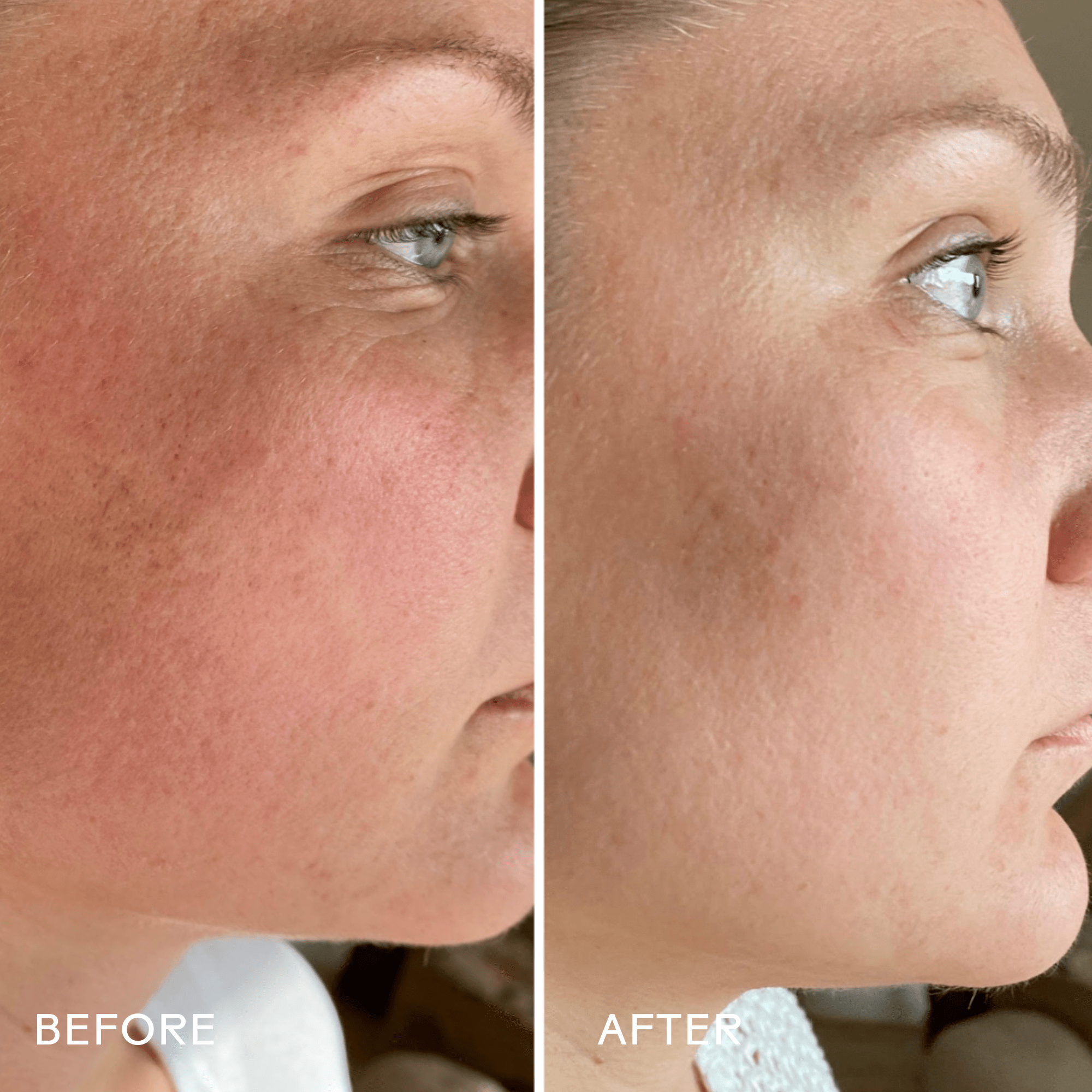 Skin Hero Calendula + 2% Bakuchiol Bio - Retinol Serum - Free Living Co