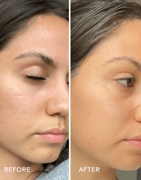 Soothe Rosehip Vitamin C Clay Mask - Free Living Co