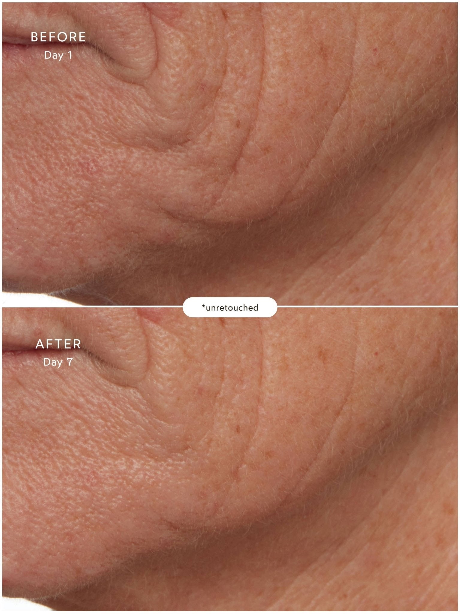 SuperSEA Firming & Lifting Treatment - Free Living Co