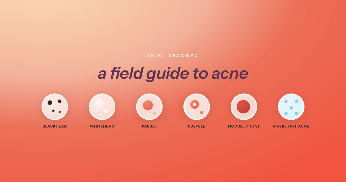 The Types of Acne, Explained - Free Living Co