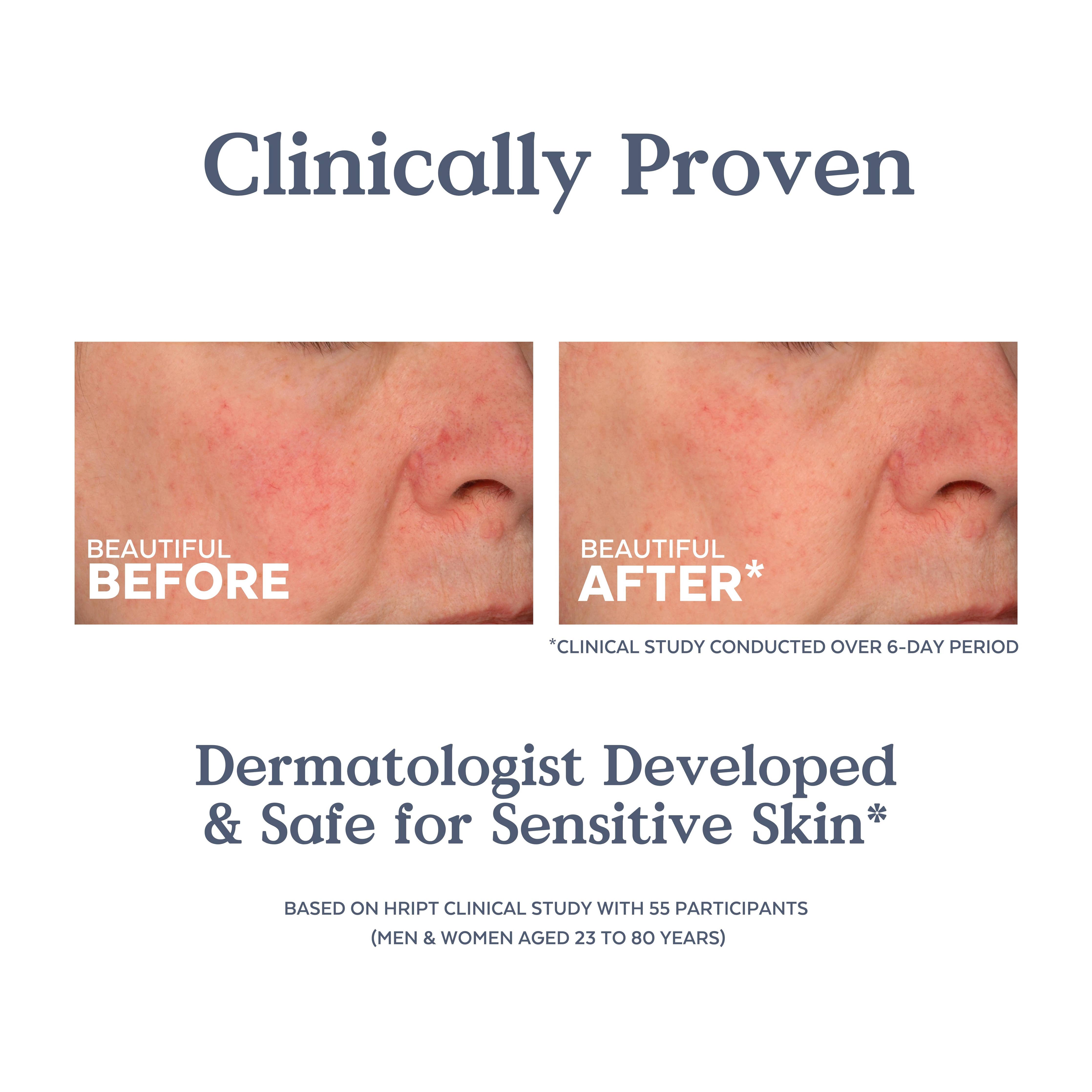 Replenish Ceramides + Blueberry Barrier Repair Serum - Free Living Co