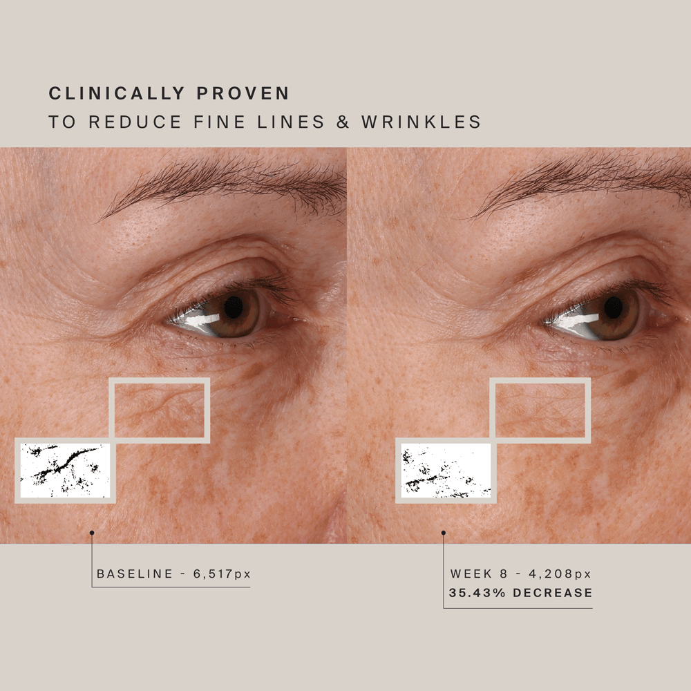 HigherDOSE Red Light Face Mask - Free Living Co